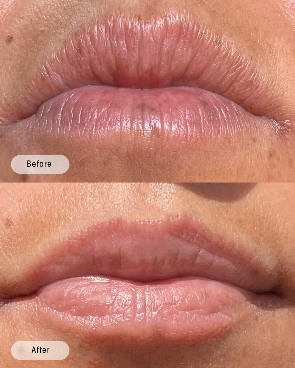 Lips